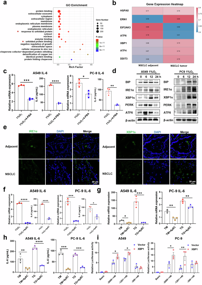 Fig. 5: Tumour cells massively secrete IL-6 through activation of the IRE1α-XBP1s axis.