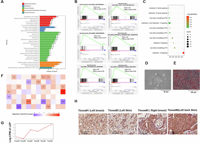 Fig. 3: KEGG and Gene Set Enrichment Analyses (GSEA) were performed on primary and cutaneous breast cancer tissues.