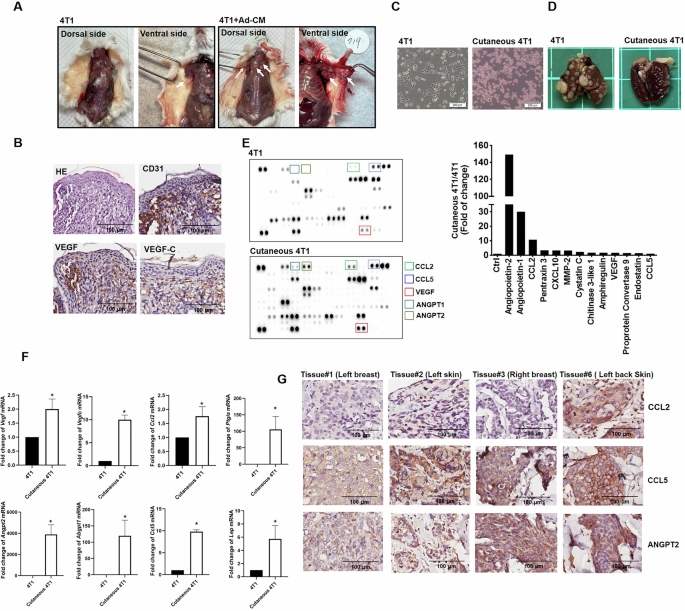 Fig. 4: Cutaneous 4T1 cells exhibit the angiogenic and skin-metastatic properties characteristic of breast cancer cells.