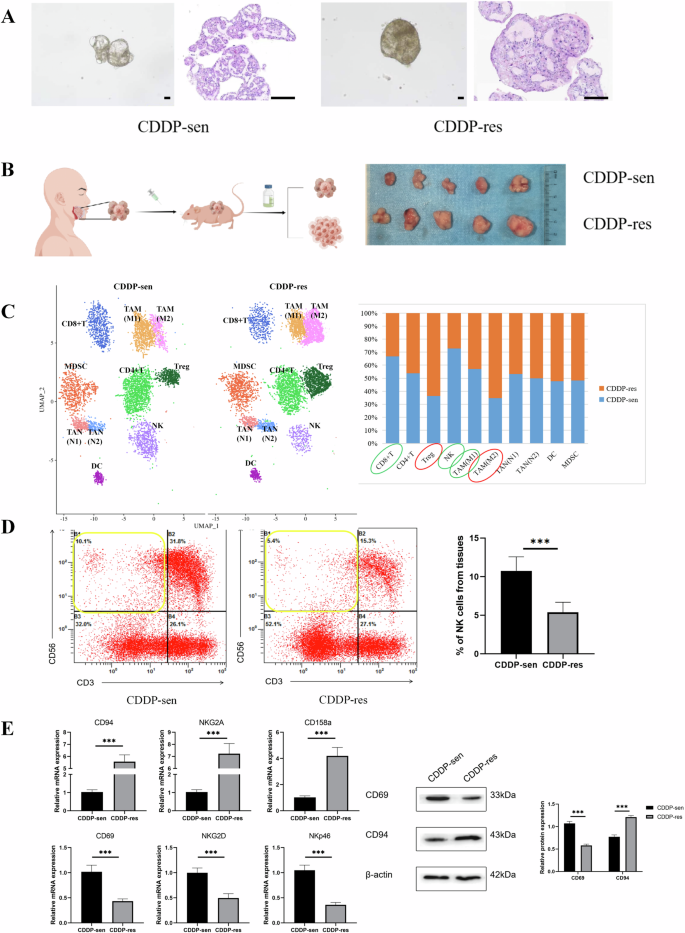 Fig. 1: The content and activity of NK cells were found to be reduced in the tissues of TSCC that exhibited resistance to cisplatin.