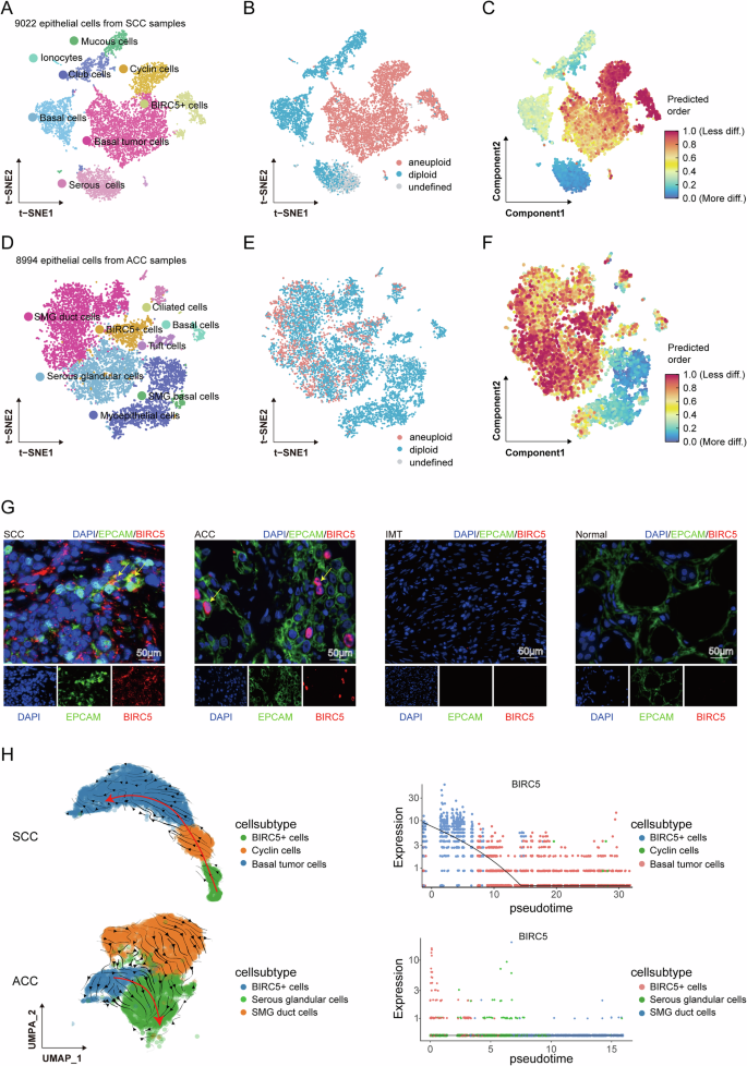 Fig. 2: Characterization of the epithelial cells in SCC, ACC, and normal tissue samples.
