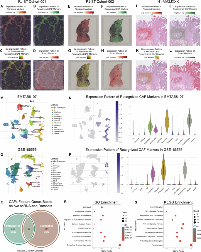 Fig. 1: Identification and validation of CAF feature genes at single-cell and spatial transcriptomics levels.