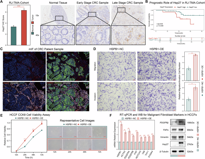 Fig. 8: HSPB1 overexpression promotes worse prognosis in CRC and malignant characteristics in CAFs.