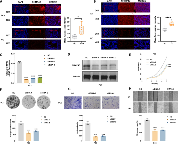 Fig. 8: Functional experimental validation for the high CHMP4C expression in prostate cancer (PCa) and testicular cancer (TC).