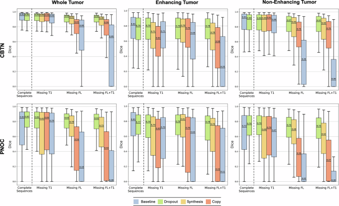 Fig. 2: Segmentation Performance Under Complete and Missing MRI Scenarios Across Imputation Strategies.