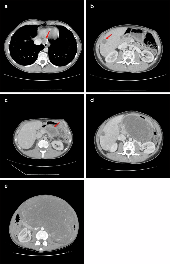 Fig. 2: CT imaging of the patient under treatment.