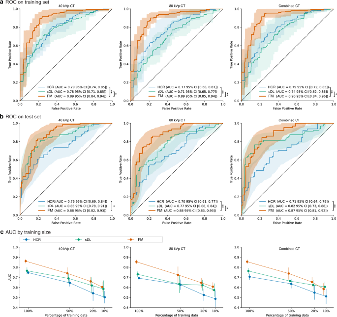 Fig. 3: Receiver operating characteristic (ROC) curves and area under the curves (AUCs) for HRD classification across CT energy levels.