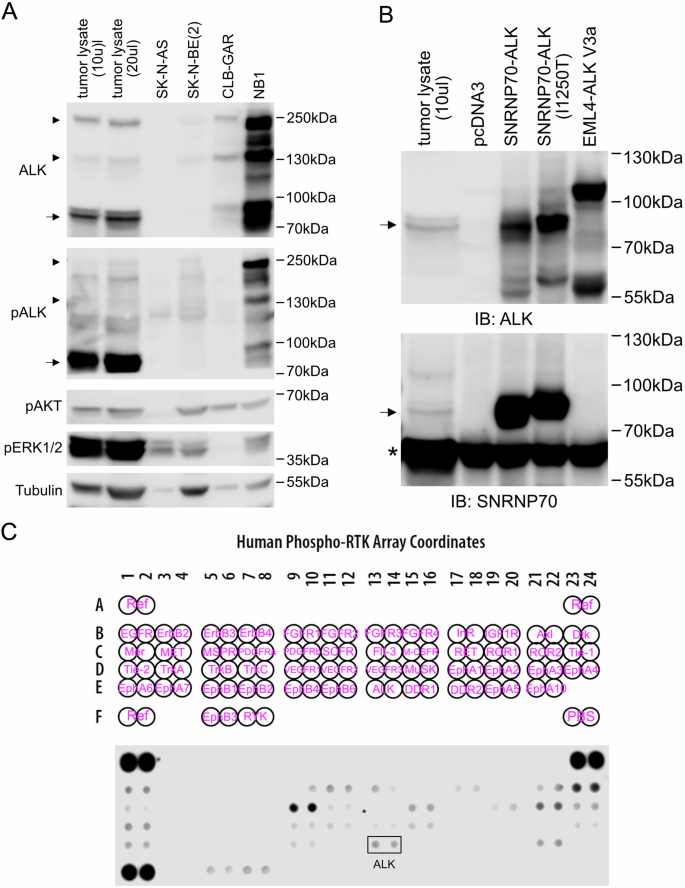 Fig. 3: Characterization of SNRNP70::ALK fusion protein.