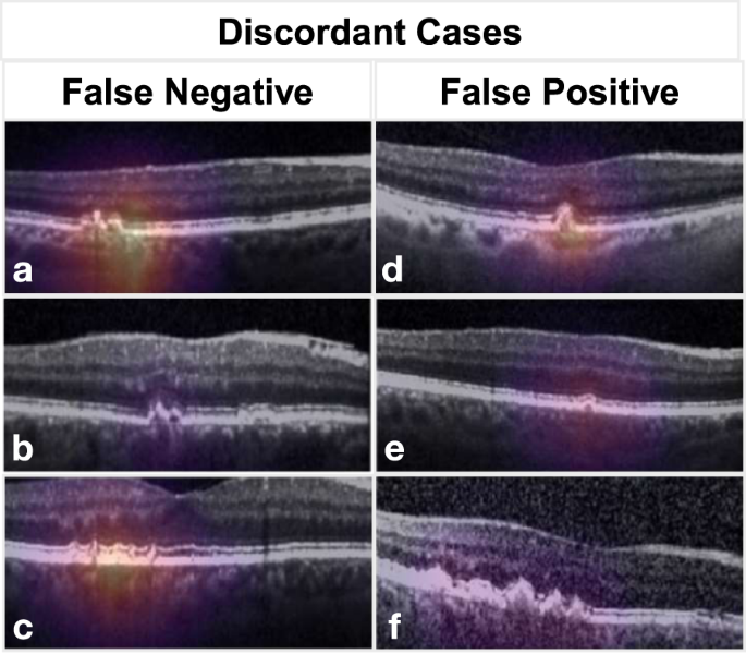 Fig. 4: Examples of discordant cases.