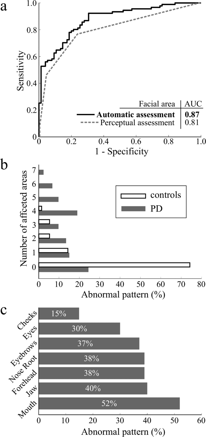 Fig. 2: Results of hypomimia sensitivity analysis.