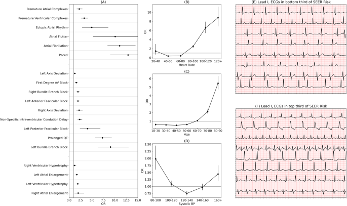 Fig. 4: SEER is consistent with known ECG risk factors.