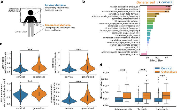 Fig. 4: Comparison of generalised and cervical dystonia patients using kinematics variables.