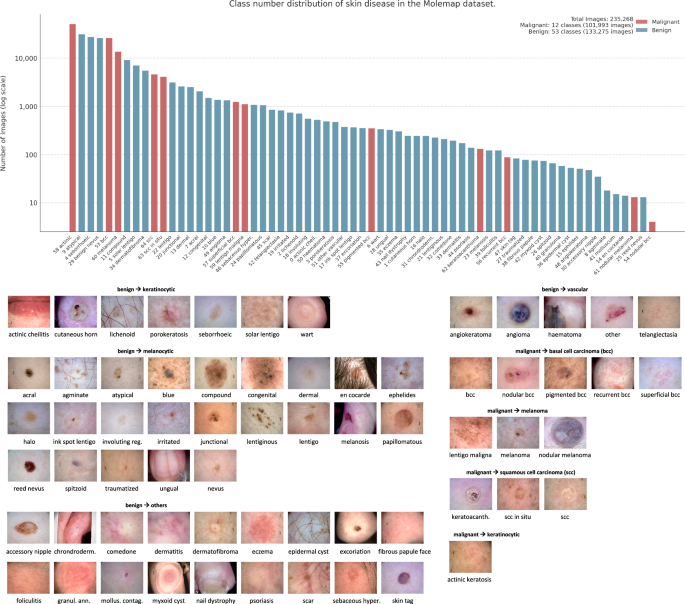 Fig. 14: Class distribution in the Molemap dataset, organized by hierarchical categories.