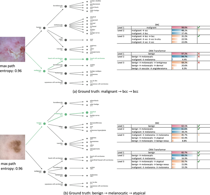 Fig. 6: Correct prediction samples for the proposed HPDT model and comparison with two other hierarchical models.