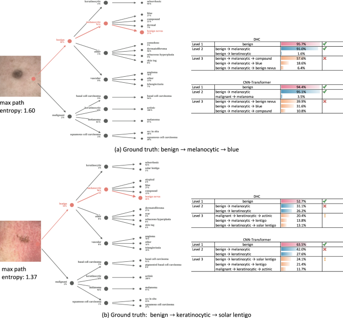Fig. 7: Incorrect prediction samples for the proposed HPDT model and comparison with two other hierarchical models.