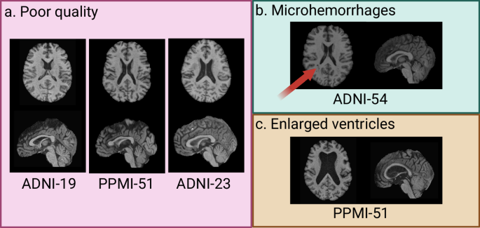 Fig. 6: Examples of real images flagged as harmful and eliminated by the travelling model with quality control.