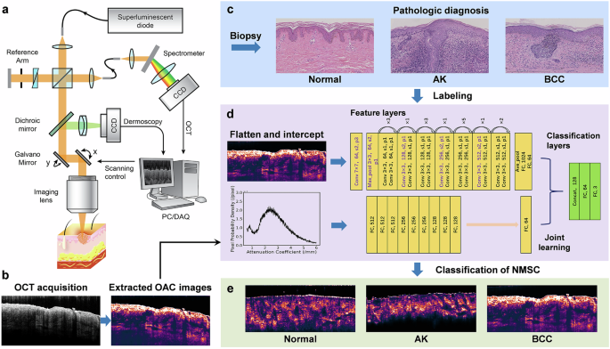 Fig. 1: Schematic diagram of the OCT skin imaging system and the joint learning process.