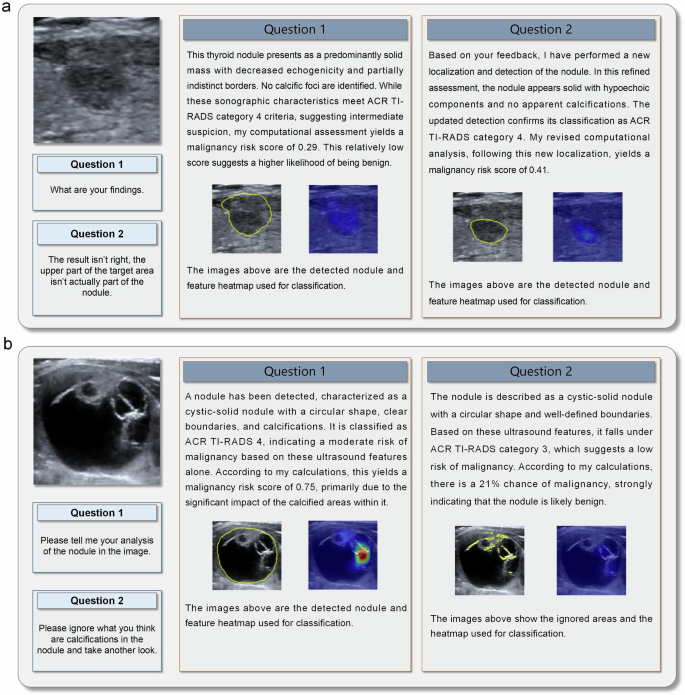 Fig. 5: Radiologist insists on the initial diagnosis after communicating with ThyGPT.