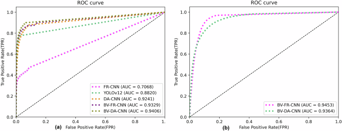 Fig. 5: ROC curves and AUC values by various backbones.