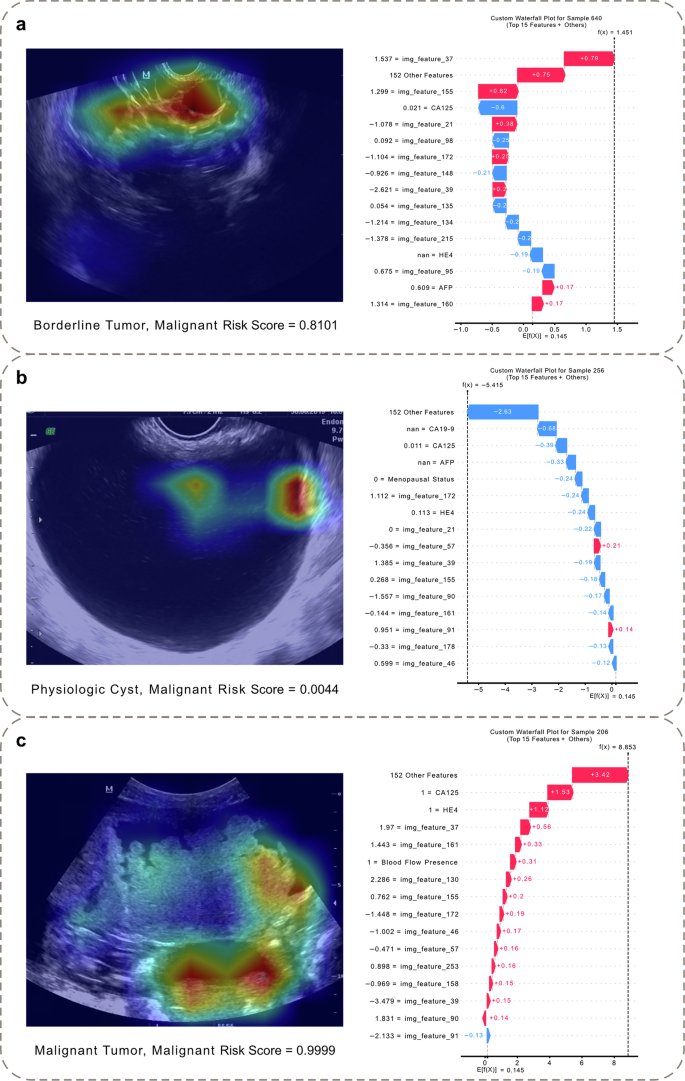 Fig. 6: Interpretability of individual case predictions.