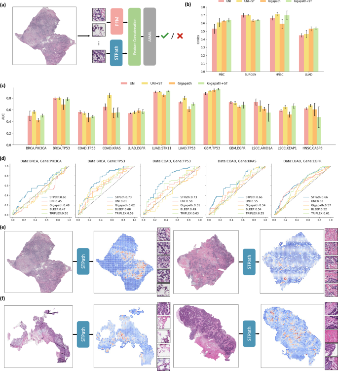 STPath: a generative foundation model for integrating spatial ...