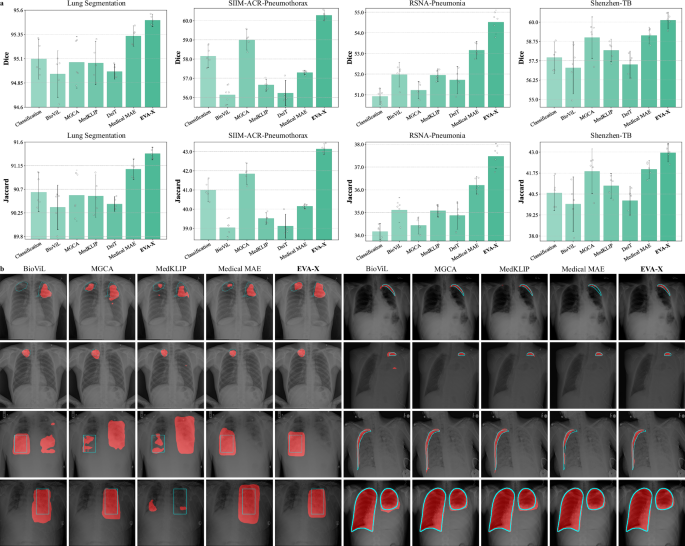 Fig. 4: Performance on Segmentation Tasks.