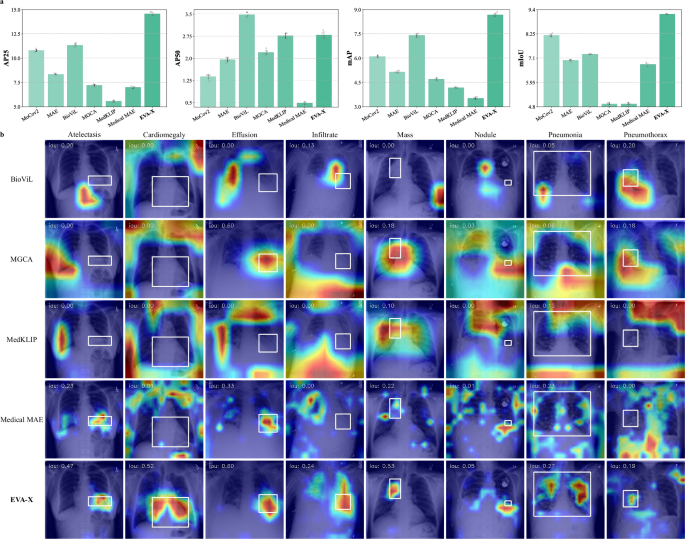 Fig. 5: Performance on Interpretability.