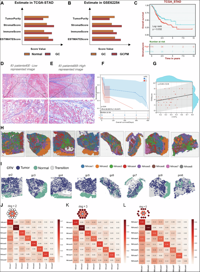 Fig. 2: Comparison of stromal characteristics and spatial Niche neighborhood relationships in GC and GC Peritoneal Metastasis (GCPM) Patients.