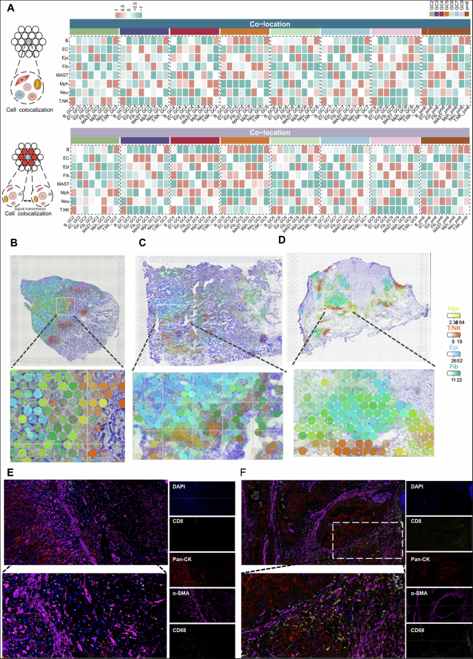 Fig. 3: Spatial localization features of distinct cell populations in the GC microenvironment.