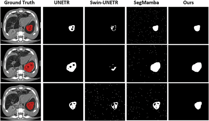 Fig. 3: Qualitative results and visualization (Set 1).