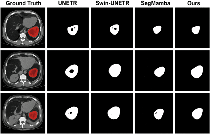 Fig. 4: Qualitative results and visualization (Set 2).