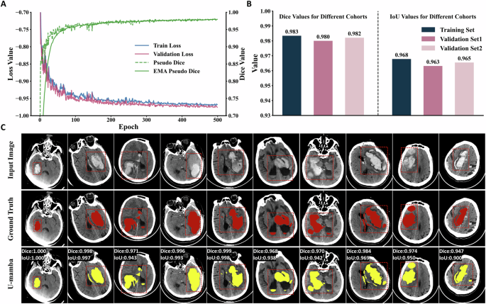 Fig. 4: Full-scale training and evaluation of the U-Mamba segmentation model.