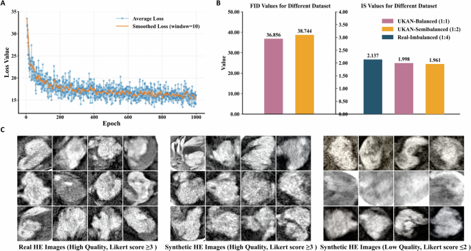 Fig. 5: Evaluation of Diffusion-UKAN synthetic data augmentation.
