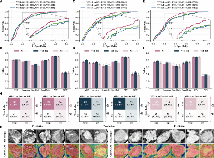 Fig. 6: Performance comparison of three ViT classifiers for hematoma expansion prediction.