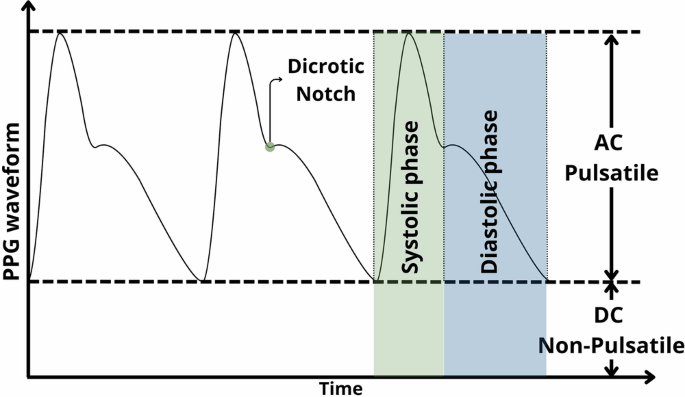 Fig. 3: Schematic representation of the PPG waveform.