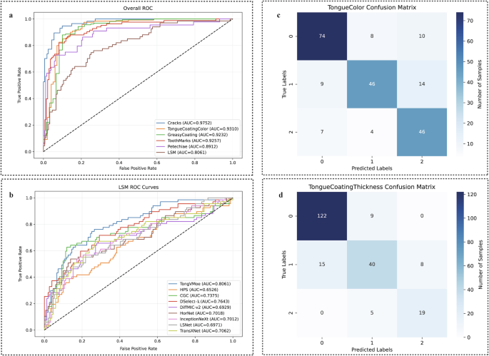 Fig. 2: ROC curves and confusion matrices of the TongVMoe model and comparison models on the test set.