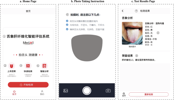 Fig. 4: User interface of the mini-program for liver fibrosis screening based on tongue image analysis.