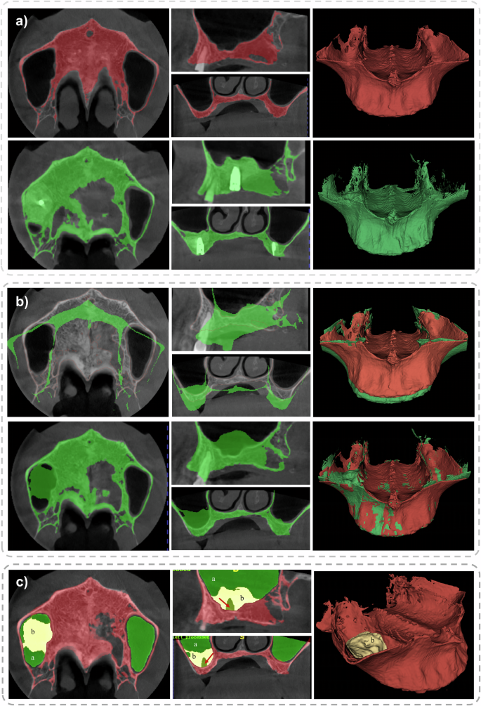 Fig. 4: Modular segmentation workflow of the SA-ai system.