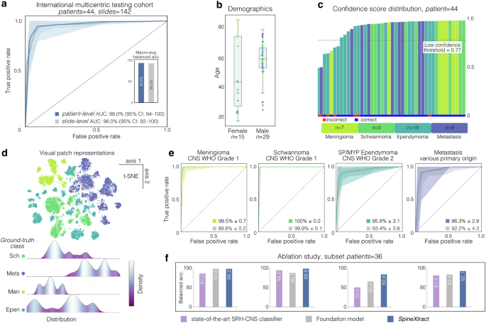 Fig. 2: Comprehensive performance evaluation of SpineXtract in an international multicentric testing cohort.