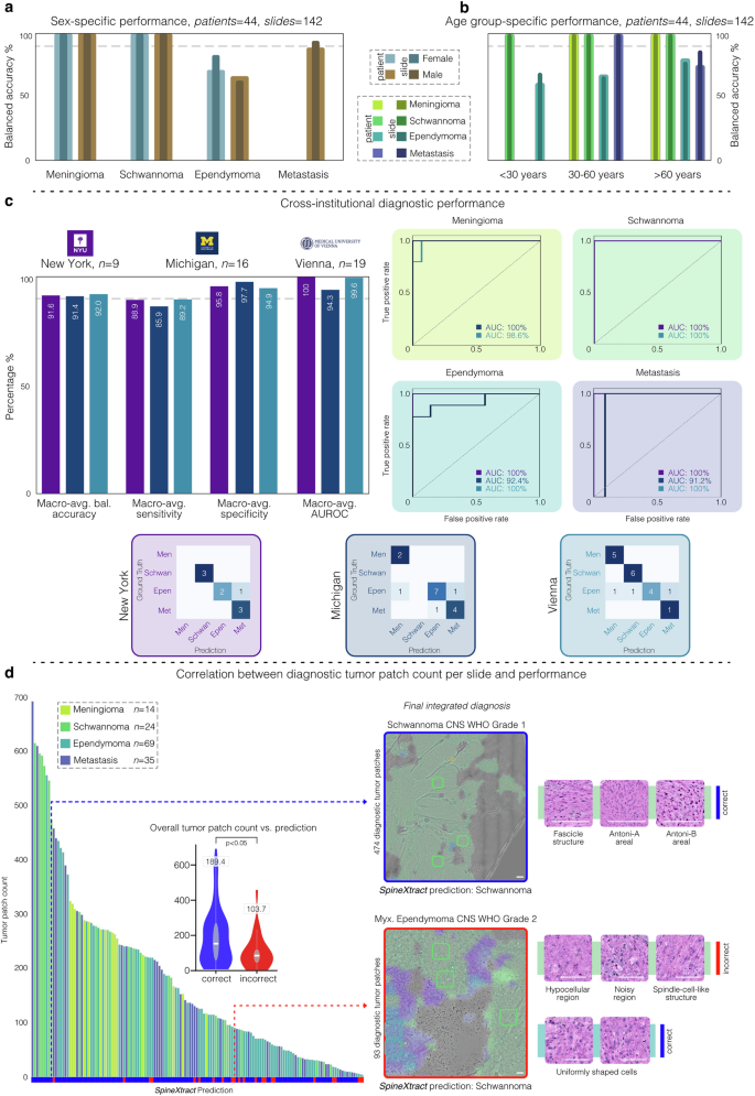 Fig. 4: Performance benchmarking comparing SpineXtract against the state-of-the-art SRH CNS classifier.