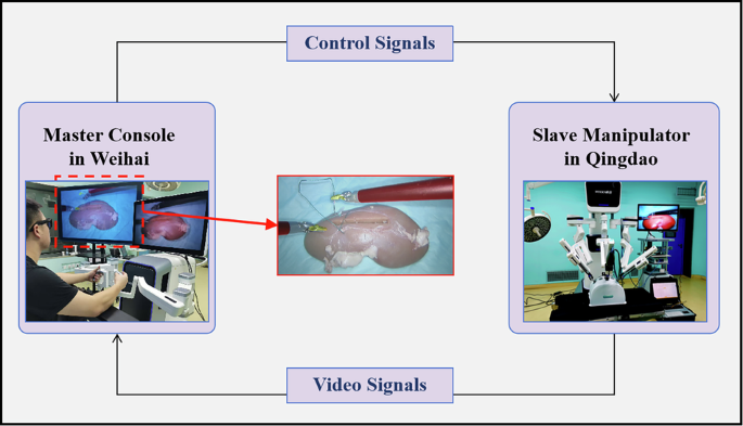 Fig. 16: Teleoperated laparoscopic suturing task design incorporating digital twin visual assistance (DTVA) across different latency conditions.