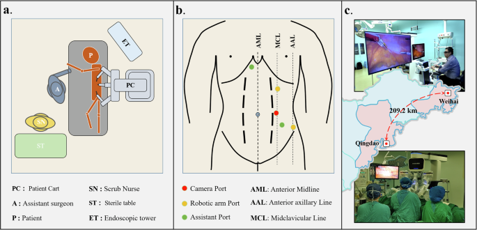Fig. 18: Clinical trial configuration for DTVA telesurgical nephrectomy.