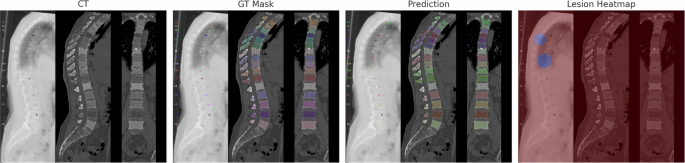 Fig. 2: Qualitative visualization.