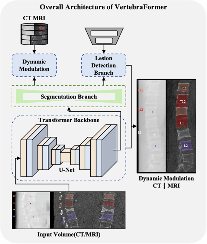Fig. 6: Overall architecture of the proposed VertebraFormer.
