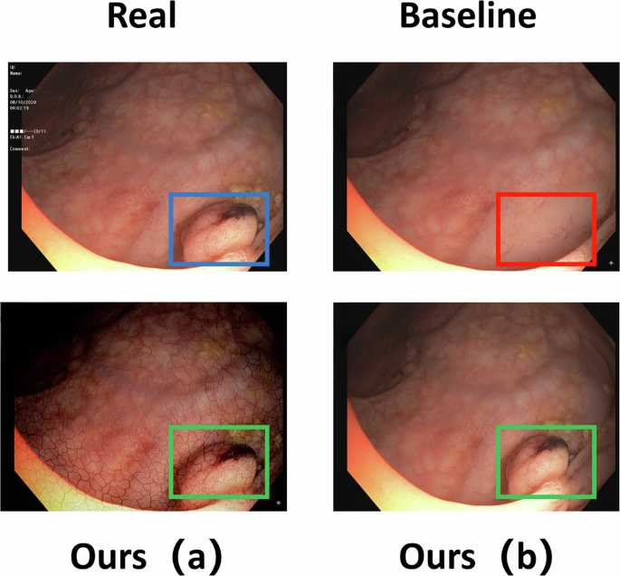 Fig. 10: Qualitative examples of error analysis on challenging lesions.