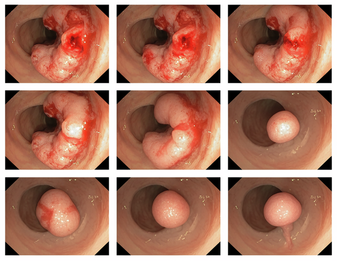 Fig. 7: Latent space interpolation.