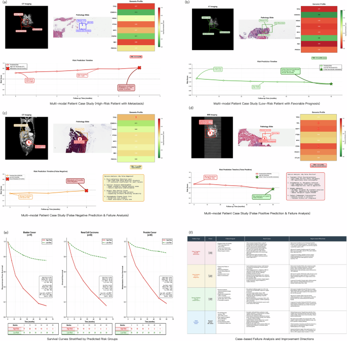 Fig. 5: Kaplan–Meier survival stratification.