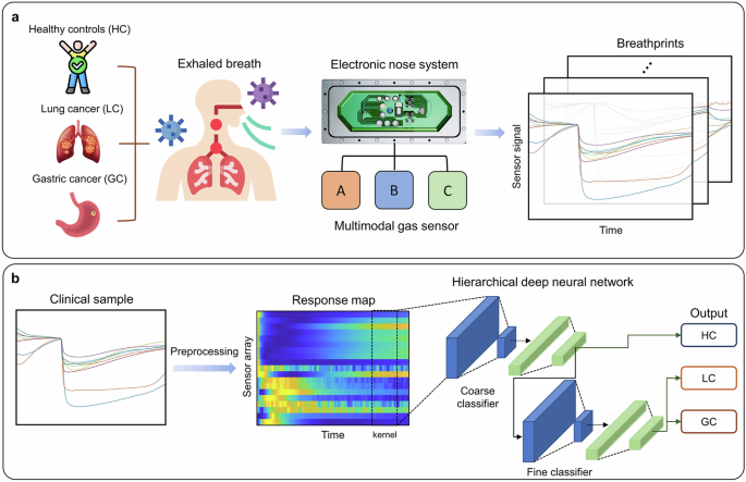 Fig. 1: Schematic illustration of breath-based cancer diagnosis using a hierarchical deep learning model.