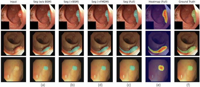 Fig. 2: Visual ablation analysis with Grad-CAM.