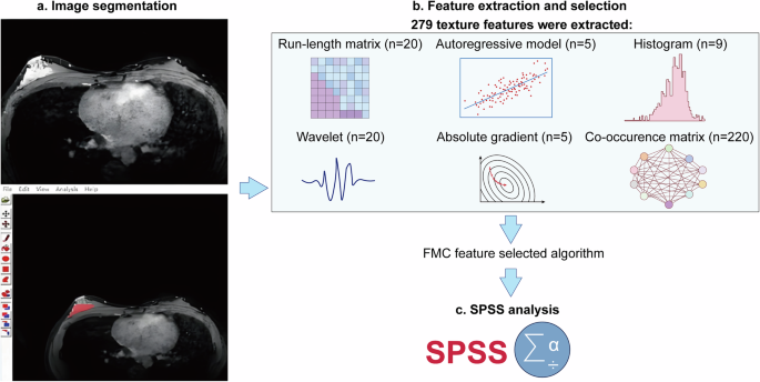 Fig. 1: Application of AI in Ultrasound Imaging: Flow Chart of Automatic Lesion Detection and Benign-Malignant Differentiation.